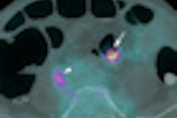 2010 05 26 11 12 12 676 Taylor pet ct Thumb 70