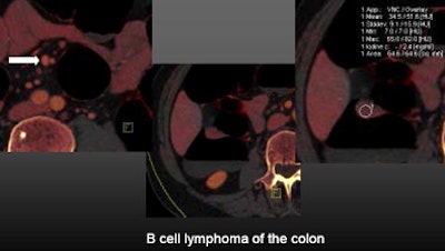 2010 05 27 12 58 51 600 Graser bcell bottom