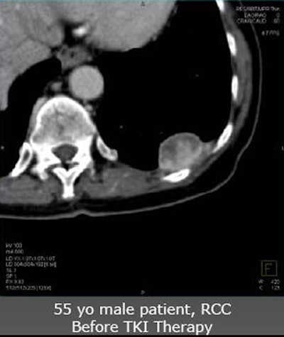 2010 06 11 14 41 17 480 Nicolau 55patient top V2