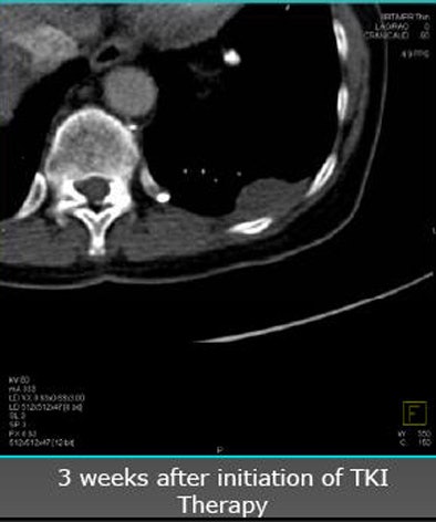 2010 06 11 14 41 18 97 Nicolau 55patient bottom V2