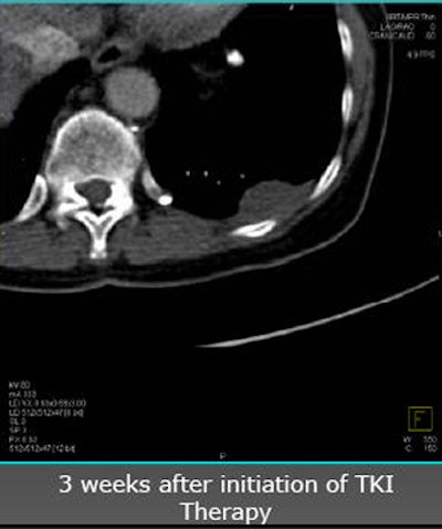 2010 06 11 14 41 18 97 Nicolau 55patient bottom V2