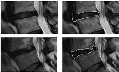 2010 06 25 15 43 18 795 Michopoulu cad segmentation