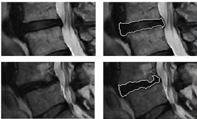 2010 06 25 15 43 18 795 Michopoulu cad segmentation
