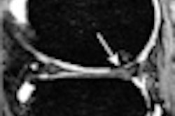 2010 06 30 10 01 11 697 Huetink Mri Osteo 70