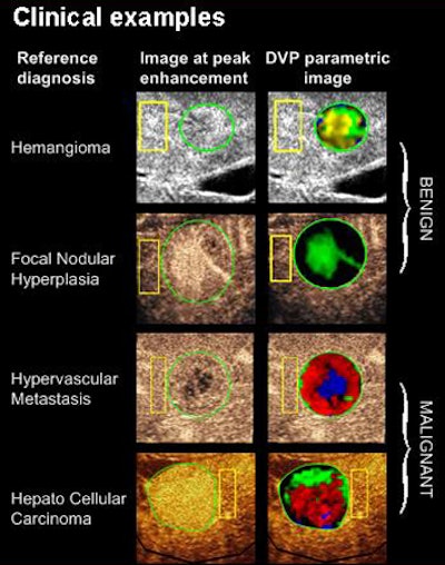 2010 07 29 13 59 53 348 Rognin clinical cases