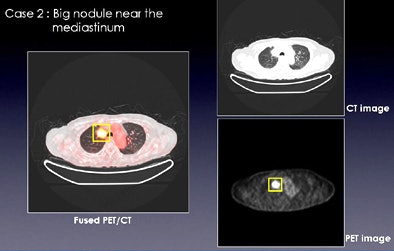 2010 07 30 13 40 58 690 Teramoto cthidden two