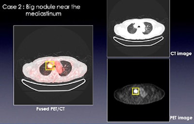 2010 07 30 13 40 58 690 Teramoto cthidden two