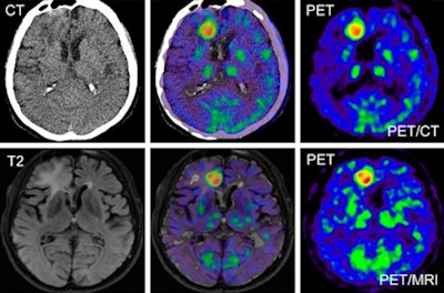 2010 07 30 15 55 33 600 Pet Ct Mri 02 450