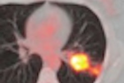 2010 09 16 11 29 19 815 Erlotinib Image Thumb