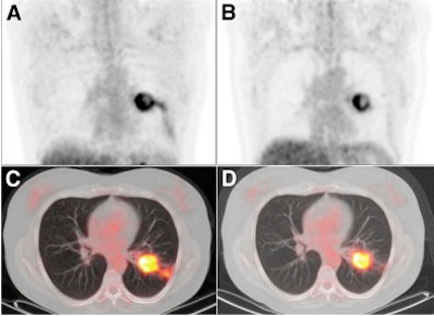 2010 09 16 11 29 20 943 Erlotinib Image 395