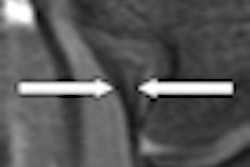 2010 09 23 11 54 26 205 Anterior Ucl 01 Original Thumb