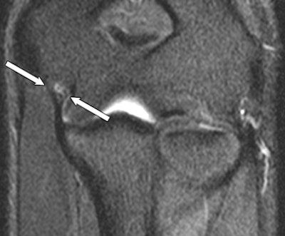 2010 09 23 11 54 26 864 Anterior Ucl 02 Original 394