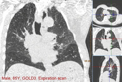 2010 09 27 11 01 11 533 Vanginneken example2 top