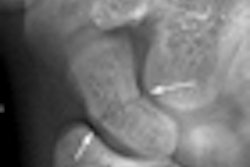 2010 11 19 11 54 20 479 2010 11 24 Image3 Thumb