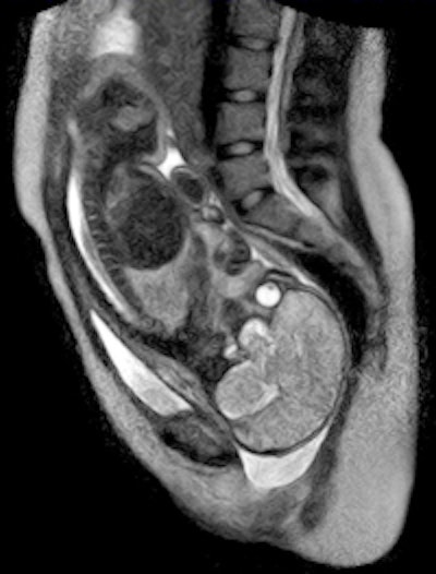 2010 12 09 13 54 04 262 Pregnant Mri Corrected 250