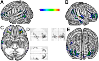 2011 01 03 13 11 10 721 Epilepsy Mazzuca 01 450
