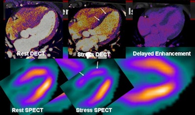 2011 01 03 14 23 42 441 Henzler example1 394