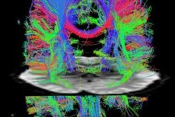 2011 01 06 10 50 21 603 Mri Brain Scan 250