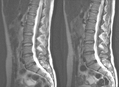 2011 01 06 11 52 02 475 Nelles Spine 01 394