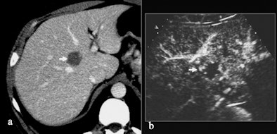 2011 01 24 12 00 51 630 Quaia A And B 394