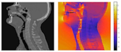 2011 02 03 14 45 07 960 Ct Mag Field Medphys 200
