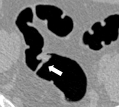 2011 02 25 12 08 56 618 Lefere 1a