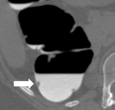 2011 02 25 12 31 48 982 Lefere 2a