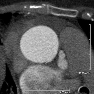 2011 03 04 10 20 46 327 Schotten 394