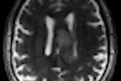 2011 03 04 13 24 21 421 2011 03 06 7 T Mri Thumb