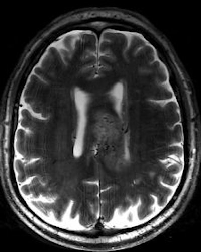 2011 03 04 13 24 22 194 2011 03 06 7 T Mri Left