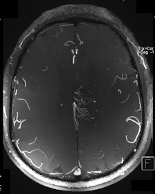2011 03 04 13 24 22 351 2011 03 06 7 T Mri Right