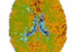 2011 03 06 15 03 09 727 2011 03 07 Brain Perfusion Thumb