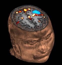 2011 03 18 12 16 45 789 2011 03 18 Coma Aberdeen Pic 2