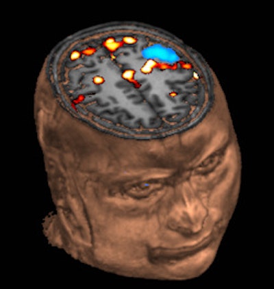 2011 03 18 12 16 45 789 2011 03 18 Coma Aberdeen Pic 2