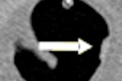 2011 03 24 14 23 25 203 2011 03 24 Ctc Thumb