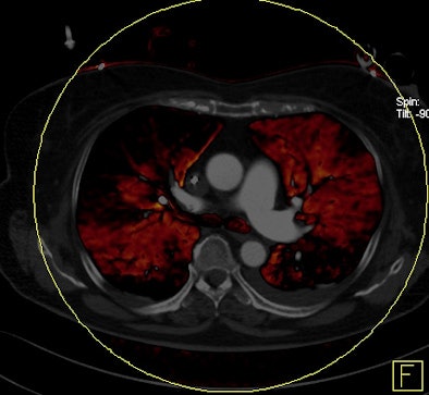 2011 03 31 11 59 19 973 Bauer 2nd 394