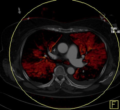 2011 03 31 11 59 19 973 Bauer 2nd 394