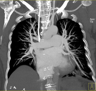 2011 03 31 11 59 21 148 Bauer 5th