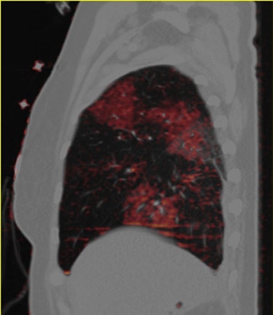 2011 03 31 11 59 23 943 Bauer 4th