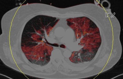 2011 03 31 11 59 24 65 Bauer 3rd