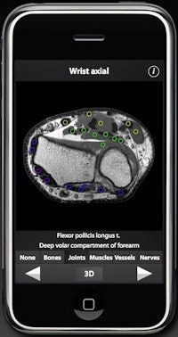 The upper limb app allows users to scroll through 500 MRI slices at intervals of 2-4 mm.