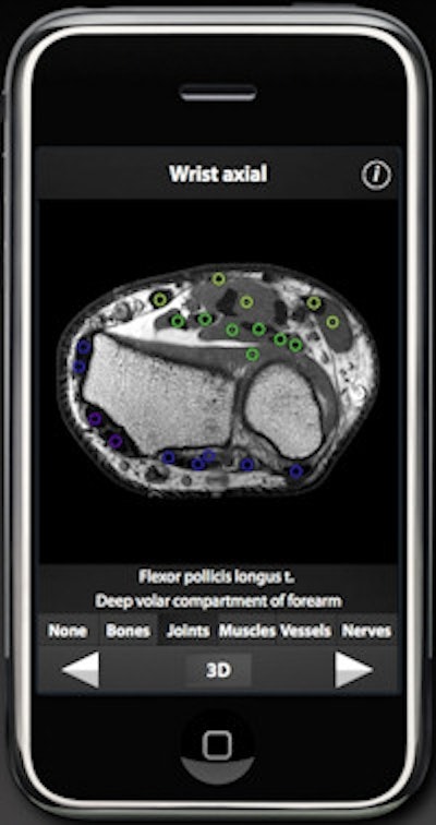 The upper limb app allows users to scroll through 500 MRI slices at intervals of 2-4 mm.