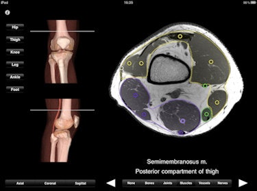 The lower limb app offers 384 MRI slices that can be viewed in sagittal, coronal, and axial planes.