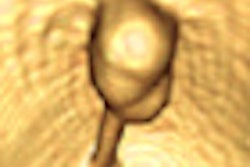 2011 04 06 13 22 33 962 Faggioni thumb 04 Comp