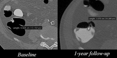 2011 04 06 13 22 39 197 Faggione polypgrew