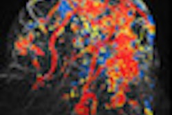 2011 04 12 09 50 40 728 2011 04 12 Breast Mri Cad Thumb