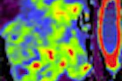 2011 04 21 11 26 42 363 2011 04 21 Goh Ct Thumb