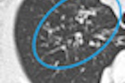 2011 04 25 13 27 43 533 Ciet thumb 05 70x70