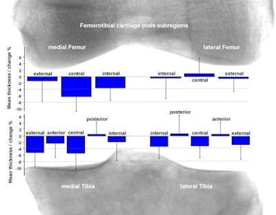 This image shows the 16 femorotibial subregions with the change in percent (before/after loading) in mean cartilage thickness upon loading with the MRI-loading device applying 50% of the participant's body weight to the investigated knee. Image courtesy of Dr. Sebastian Cotofana.