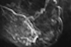 2011 04 29 20 27 33 309 2011 04 29 Mri Pic 3b Thumb2